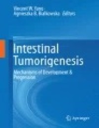 Intestinal Tumorigenesis: Mechanisms of Development & Progression