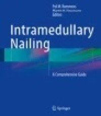 Intramedullary Nailing: A Comprehensive Guide