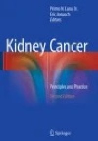 Kidney Cancer: Principles and Practice