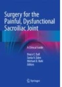 Surgery for the Painful, Dysfunctional Sacroiliac Joint