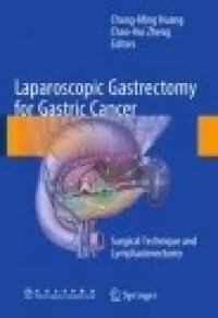 Laparoscopic Gastrectomy for Gastric Cancer: Surgical Technique and Lymphadenectomy