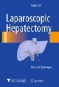 Laparoscopic Hepatectomy: Atlas and Techniques