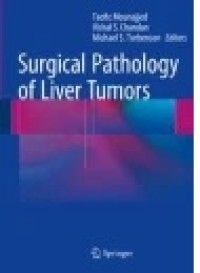 Surgical Pathology of Liver Tumors