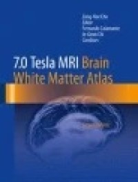 7.0 Tesla MRI Brain White Matter Atlas