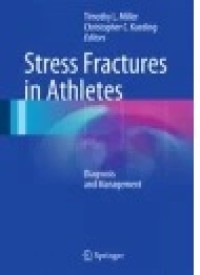 Stress Fractures in Athletes