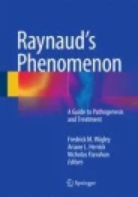 Raynaud’s Phenomenon: A Guide to Pathogenesis and Treatment