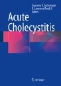 Acute Cholecystitis