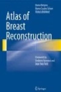 Atlas of Breast Reconstruction