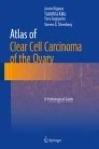 Atlas of Clear Cell Carcinoma of the Ovary : A Pathological Guide