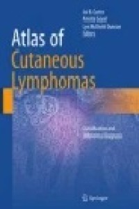 Atlas of Cutaneous Lymphomas : Classification and Differential Diagnosis