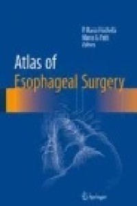 Atlas of Esophageal Surgery