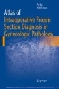 Atlas of Intraoperative Frozen Section Diagnosis in Gynecologic Pathology
