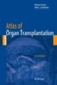 Atlas of Organ Transplantation