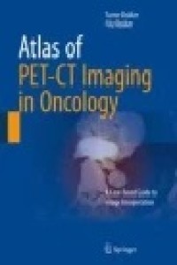 Atlas of PET-CT Imaging in Oncology : A Case-Based Guide to Image Interpretation