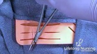 Basic Suturing: How to Suture