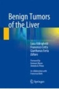 Benign Tumors of the Liver