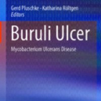 Buruli Ulcer : Mycobacterium Ulcerans Disease