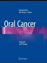 Oral Cancer : Diagnosis and Therapy