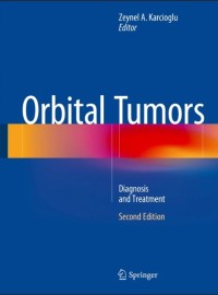 Orbital Tumors : Diagnosis and Treatment