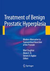 Treatment of Benign Prostatic Hyperplasia: Modern Alternative to Transurethral Resection of the Prostate