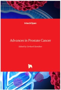 Advances in Prostate Cancer
