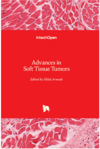 Image of Advances in Soft Tissue Tumors