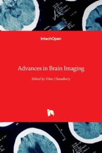 Image of Advances in Brain Imaging