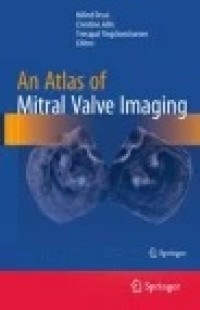 An Atlas of Mitral Valve Imaging