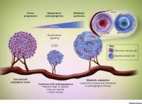 Image of Angiogenesis in Cancers