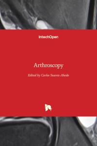 Image of Arthroscopy