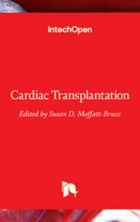 Image of Cardiac Transplantation