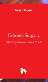 Image of Cataract Surgery