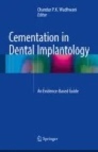 Cementation in Dental Implantology