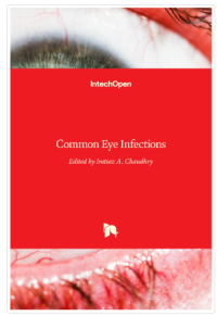 Image of Common Eye Infections