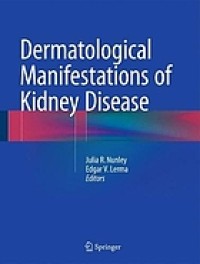 Dermatological manifestations of kidney disease