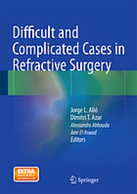 Difficult and complicated cases in refractive surgery