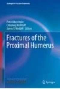 Fractures of the Proximal Humerus