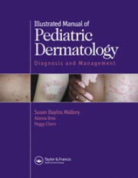 Illustrated Manual of Pediatric Dermatology : Diagnosis and Management