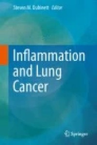 Inflammation and Lung Cancer