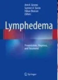 Lymphedema: Presentation, Diagnosis, and Treatment