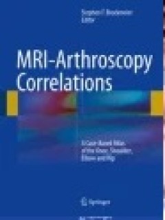 Items is not available cover