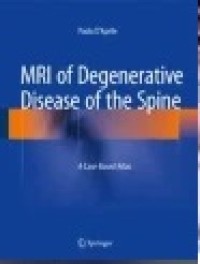 MRI of Degenerative Disease of the Spine: A Case-Based Atlas