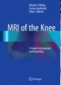 MRI of the Knee: A Guide to Evaluation and Reporting