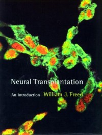 Neural Transplantation :An Introduction.