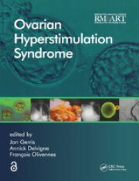 Ovarian Hyperstimulation Syndrome