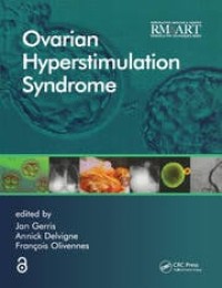 Ovarian hyperstimulation syndrome