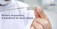 Primary Angioplasty : A Practical Guide