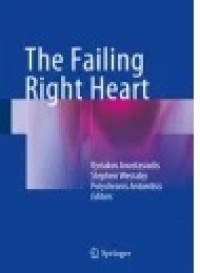 The Failing Right Heart