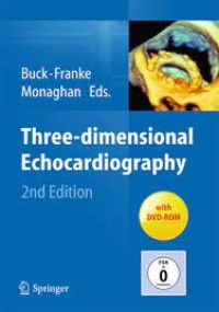 Three-dimensional Echocardiography